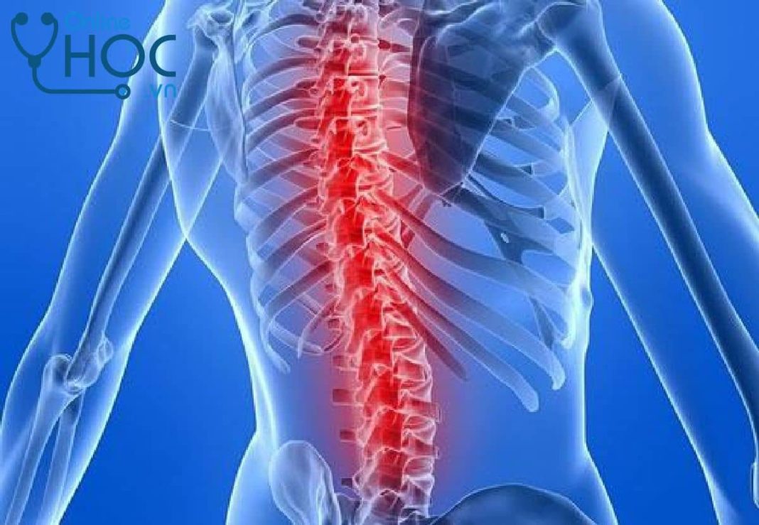 Bệnh Lao cơ xương: Nguyên nhân, triệu chứng, chẩn đoán, cách điều trị và phòng ngừa