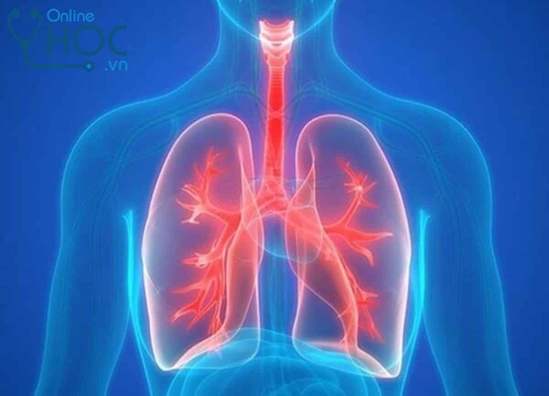 Bệnh Lao màng phổi: Nguyên nhân, triệu chứng, chẩn đoán, cách điều trị và phòng ngừa