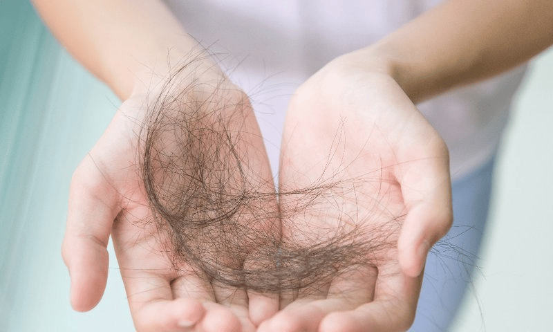 Rụng tóc do hậu Covid 19? Nguyên nhân, cách khắc phục và phòng ngừa hiệu quả, giúp tóc mọc lại nhanh: mọi người lưu lại nhé